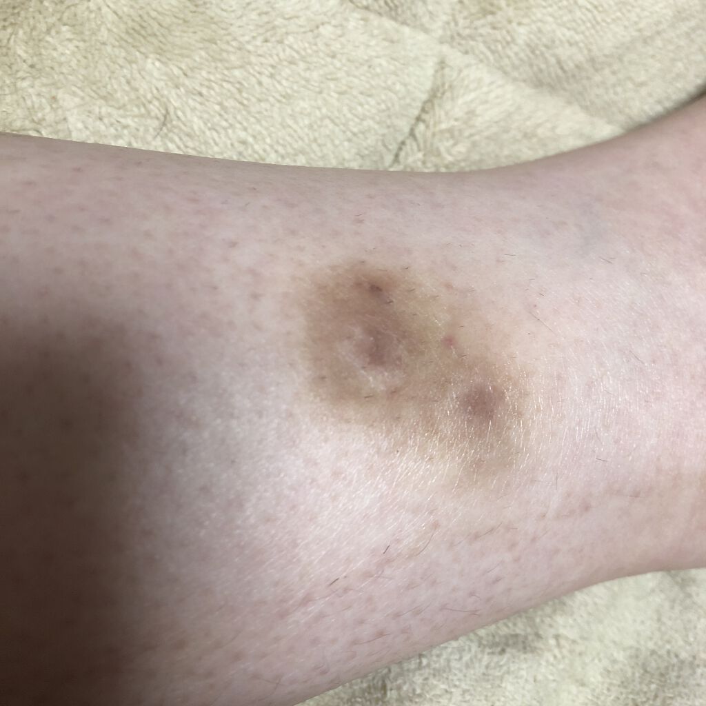 エッセンスBBパクト 20 自然なオークル系(詰替)/CEZANNE/BBクリームを使ったクチコミ（1枚目）