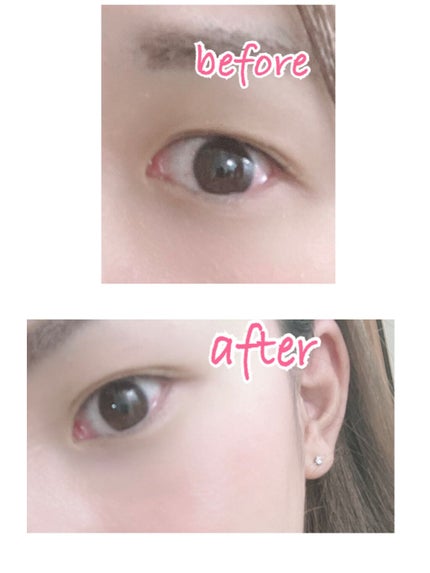 ワンダーアイリッドテープ Extra/D-UP/二重まぶた用アイテムを使ったクチコミ(4枚目)