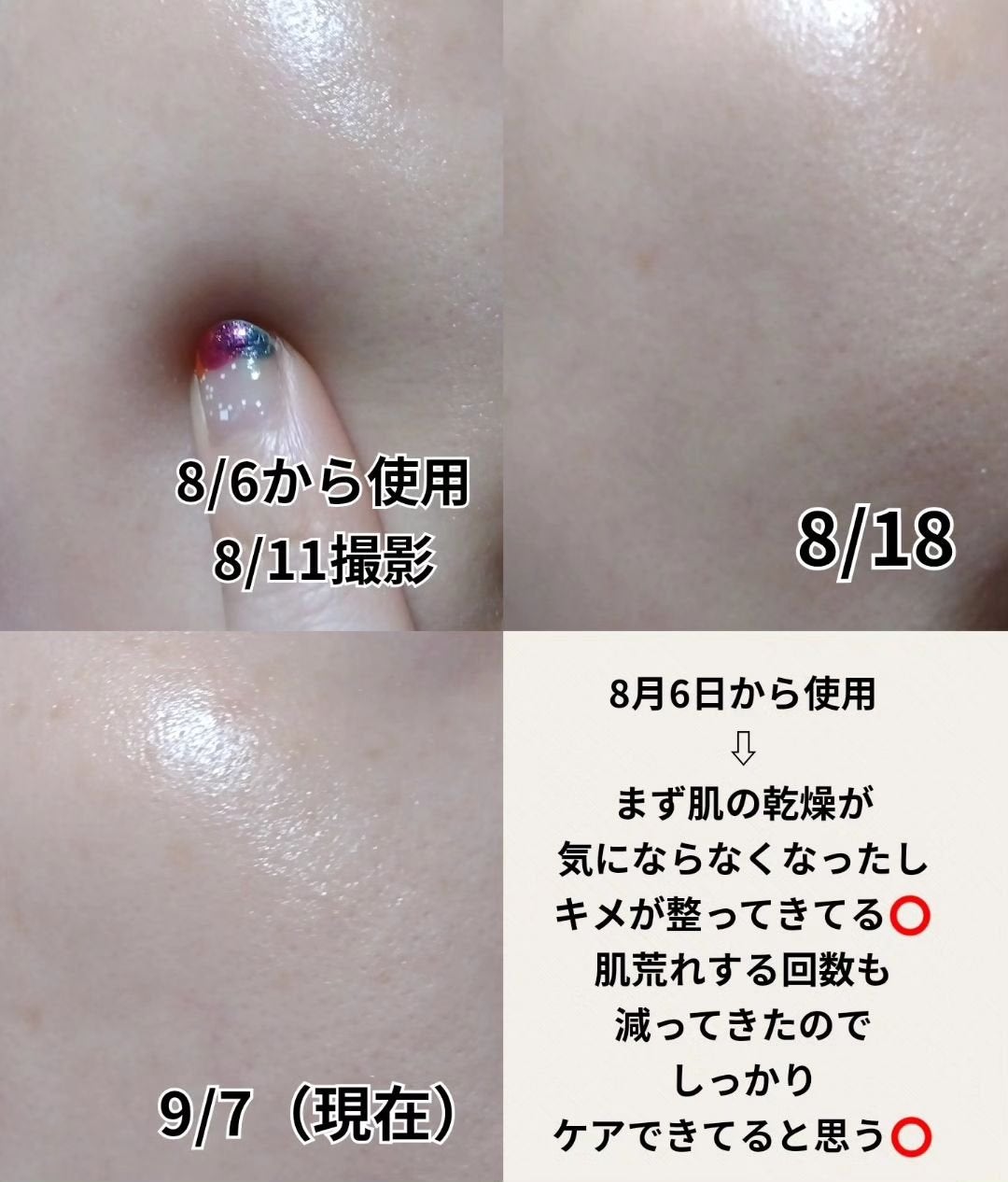 1番 シカ丸ごと水分整肌パッド/numbuzin/トナーパッドを使ったクチコミ(5枚目)