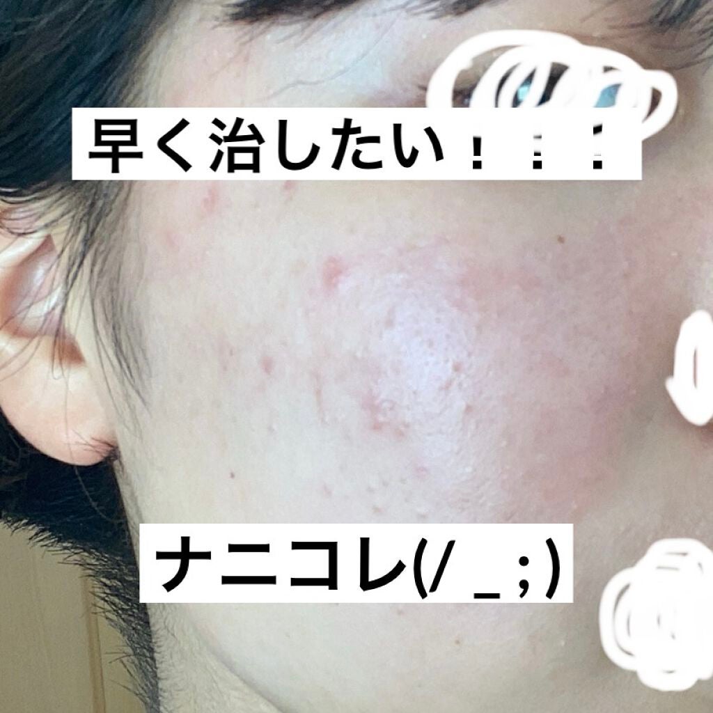 潤浸保湿 化粧水 III とてもしっとり/キュレル/化粧水を使ったクチコミ(1枚目)