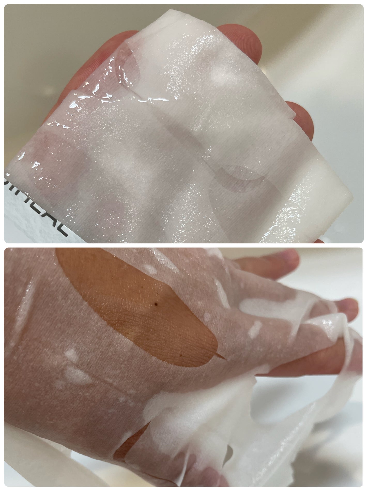 マデカソサイドエッセンシャルマスク/MEDIHEAL/シートマスク・パックを使ったクチコミ(2枚目)