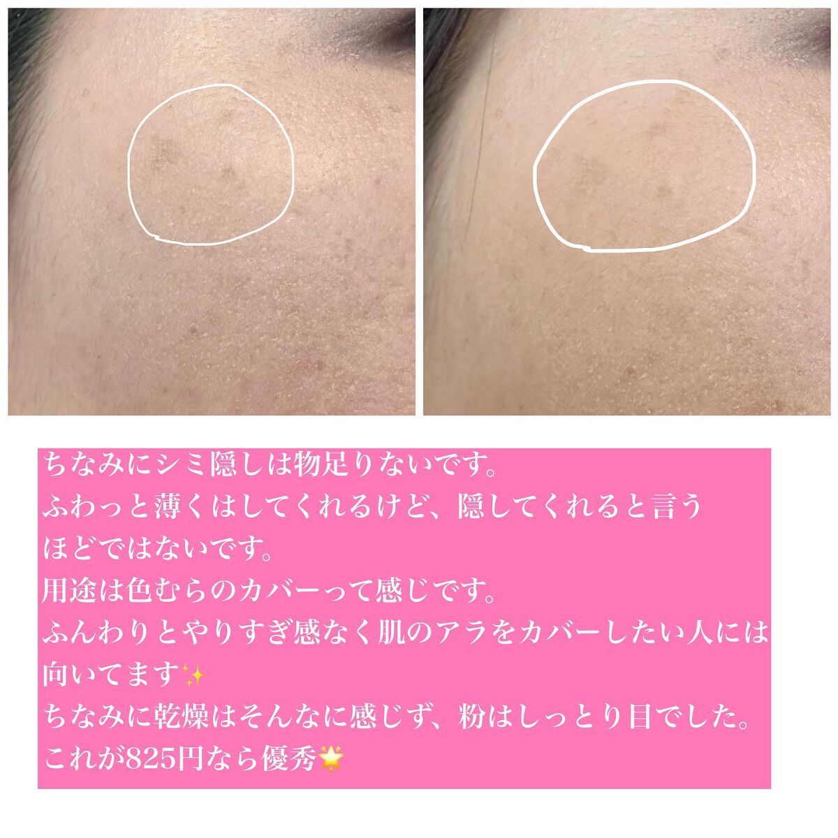 パステルヴェールコンシーラー/キャンメイク/パレットコンシーラーを使ったクチコミ(6枚目)