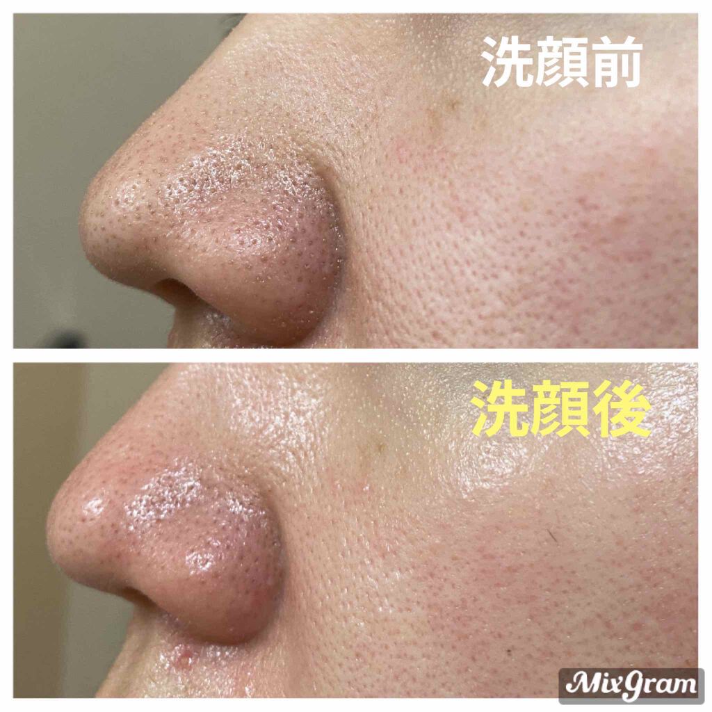 R.N.A. パワー ラディカル ニュー エイジ/SK-II/乳液を使ったクチコミ（3枚目）