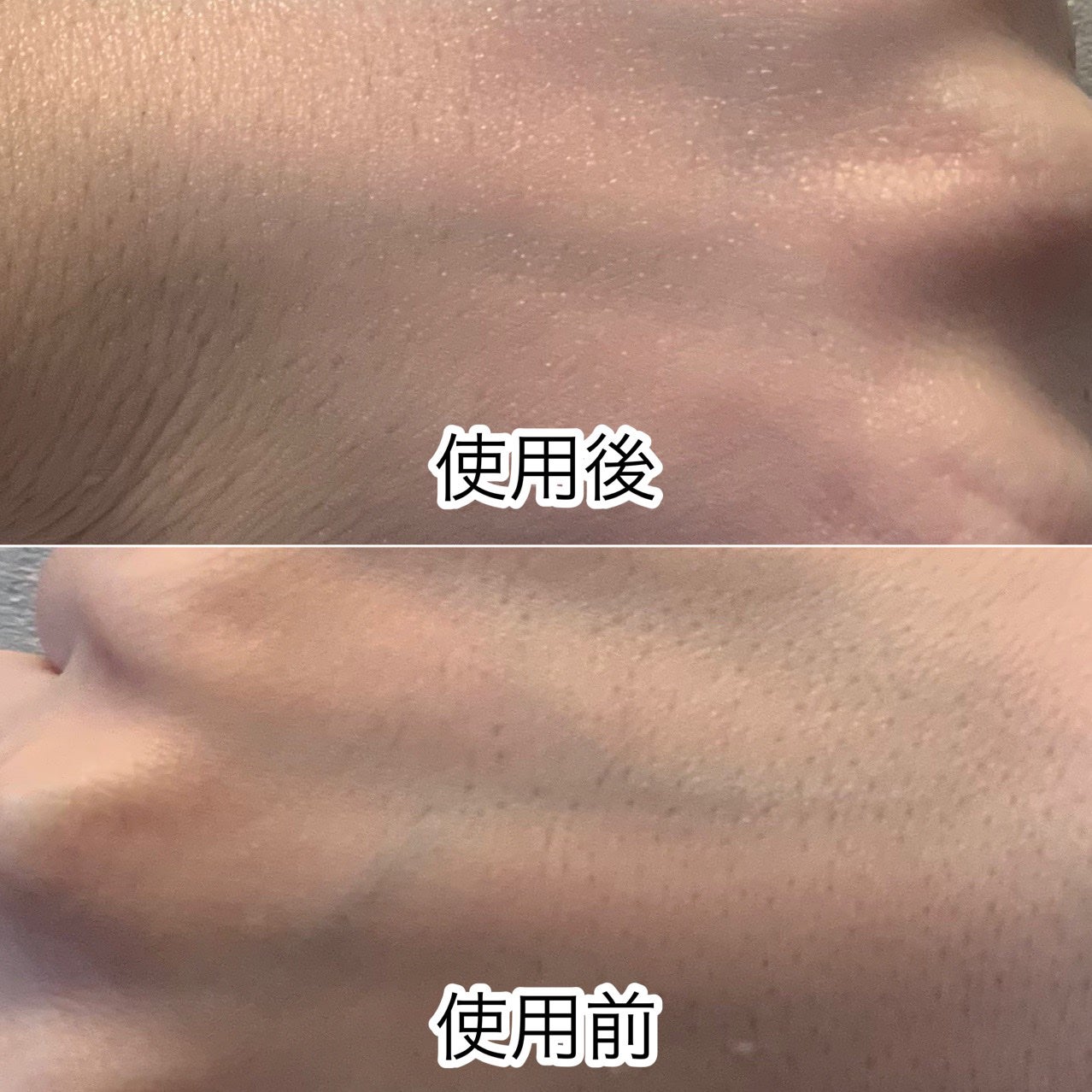 グランラグゼ III/B.A/美容液を使ったクチコミ(3枚目)