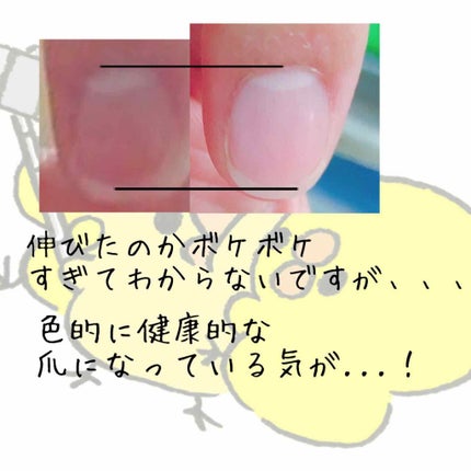 ウィンマックス キューティクルオイル/DAISO/ネイルオイル・トリートメントを使ったクチコミ(3枚目)