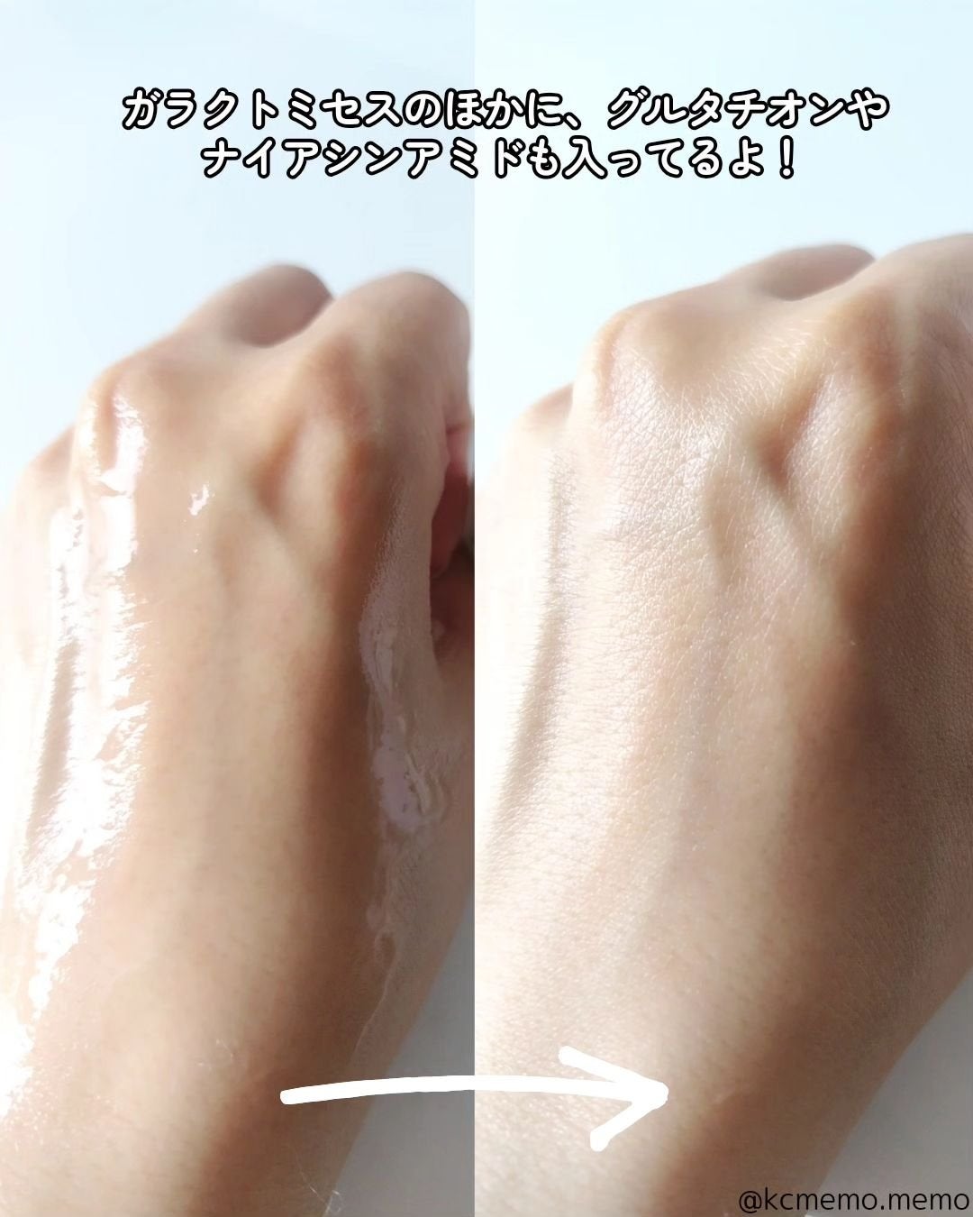 ガラクナイアシン2.0エッセンス/manyo/美容液を使ったクチコミ(4枚目)