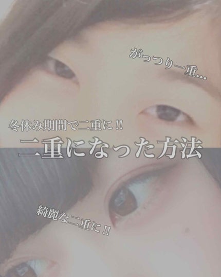 アイトーク/アイトーク/二重まぶた用アイテムを使ったクチコミ(1枚目)