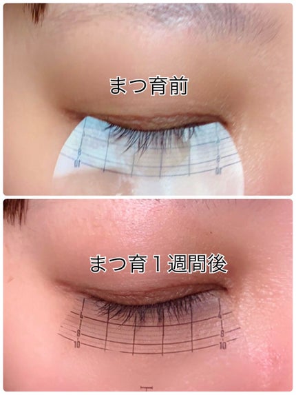 エターナルアイラッシュ/リュバンブラン/まつげ美容液を使ったクチコミ(4枚目)