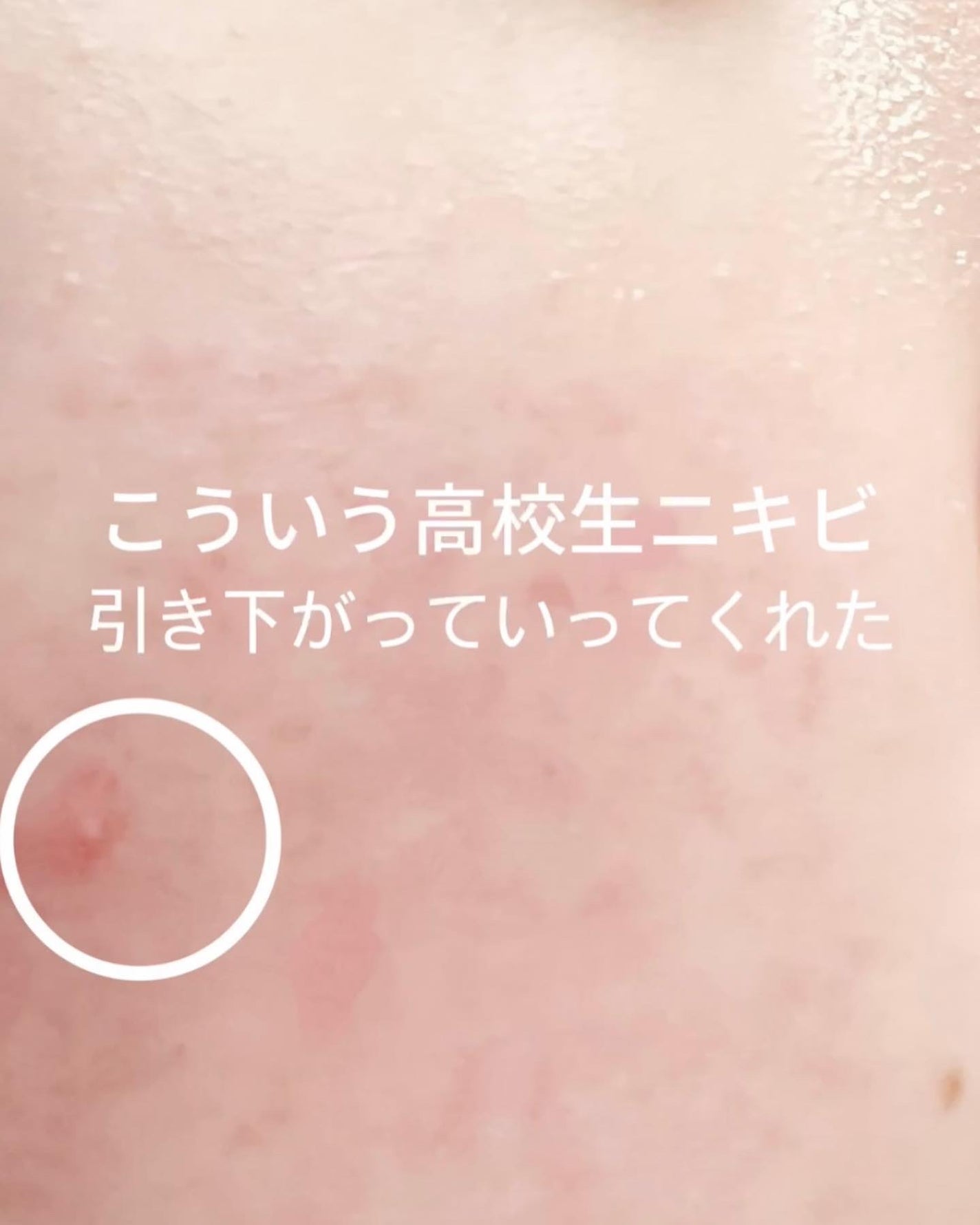 ok.mama33 on LIPS ãBLANCð¿ãããèèãã®æ¹è©ŠããŠã¿ãŠã»ããã§ãð¿ãããããå®..ãïŒ6æç®ïŒ