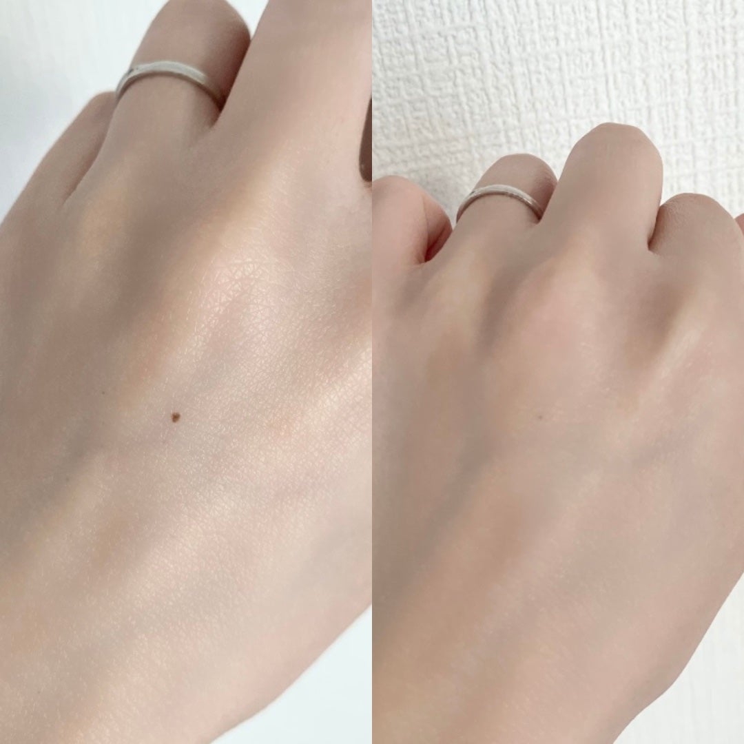 はっち on LIPS 「LIPSベストコスメ2023下半期こだわりアワードコンシーラー..」(5枚目)