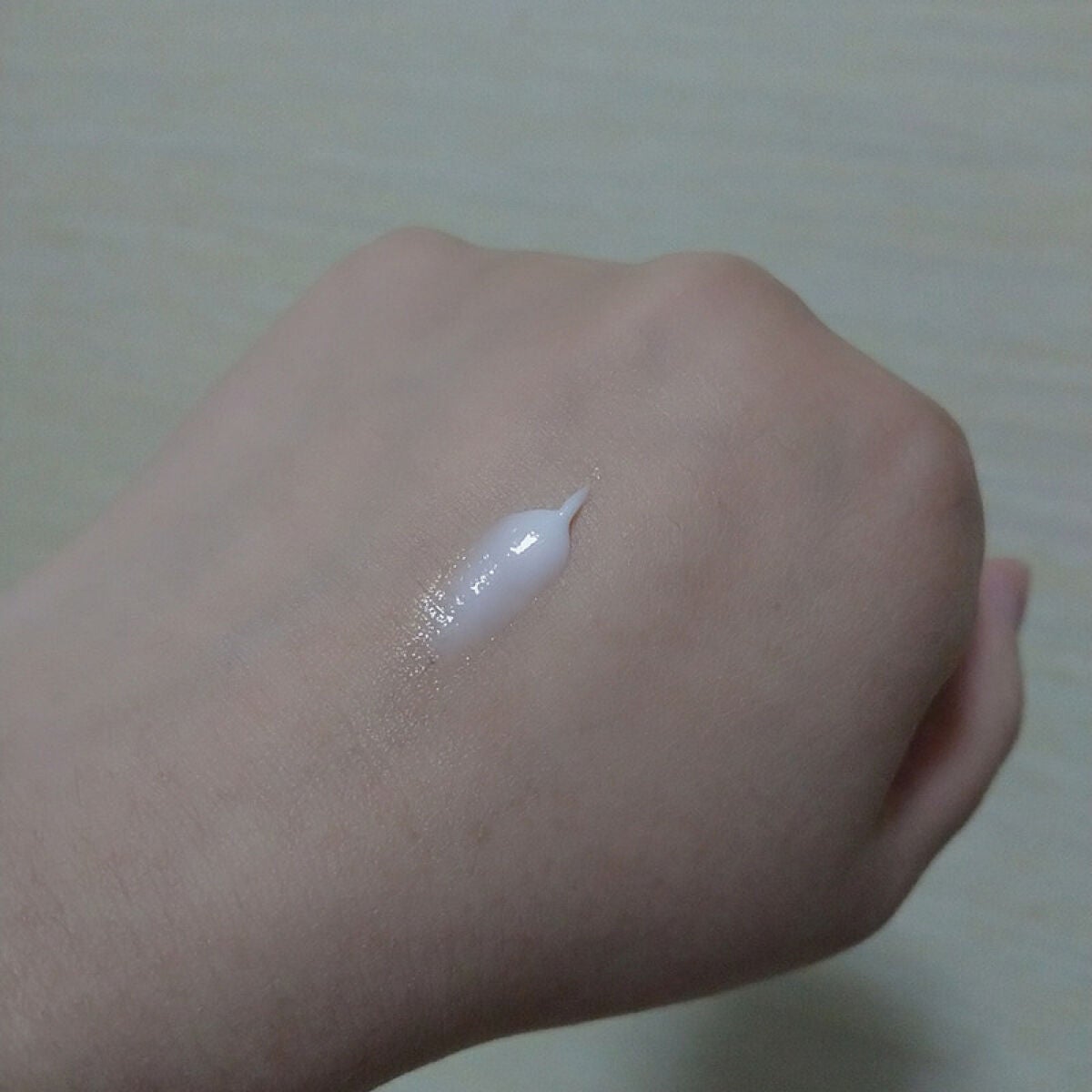 薬用 美白アクネホワイトクリーム 専用パッチ付/アクネスラボ/その他キットセットを使ったクチコミ(2枚目)