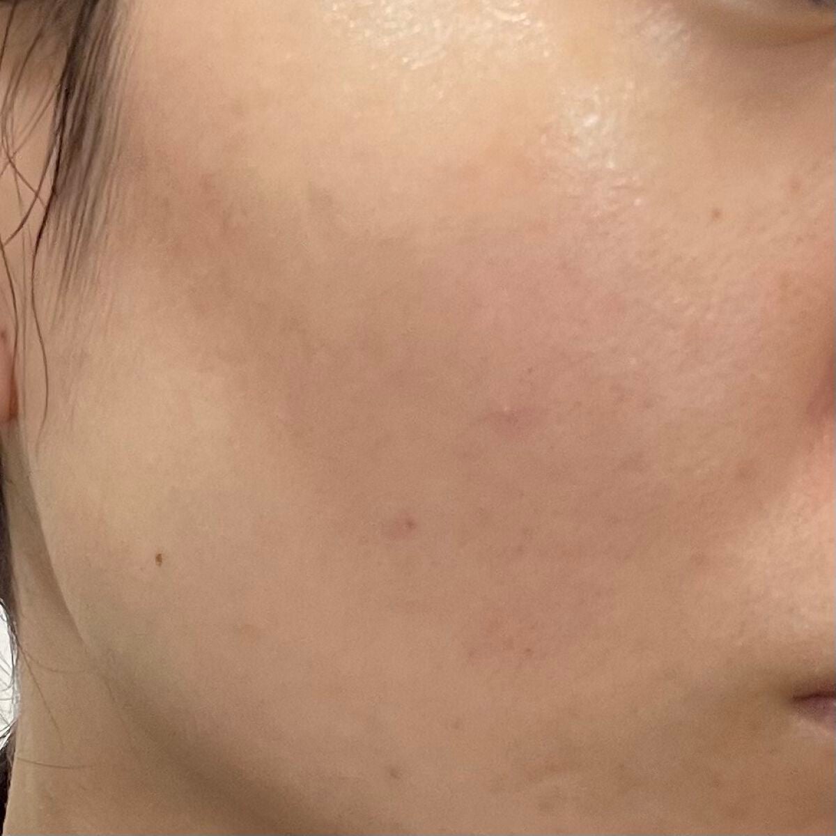 ブラック クッション/HERA/クッションファンデーションを使ったクチコミ(2枚目)