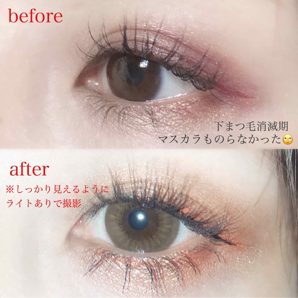 スカルプd ボーテ ピュアフリーアイラッシュセラム アンファーの効果に関する口コミ まつ育について 先月あたりからまつ毛が抜 By みみ 敏感肌 Lips