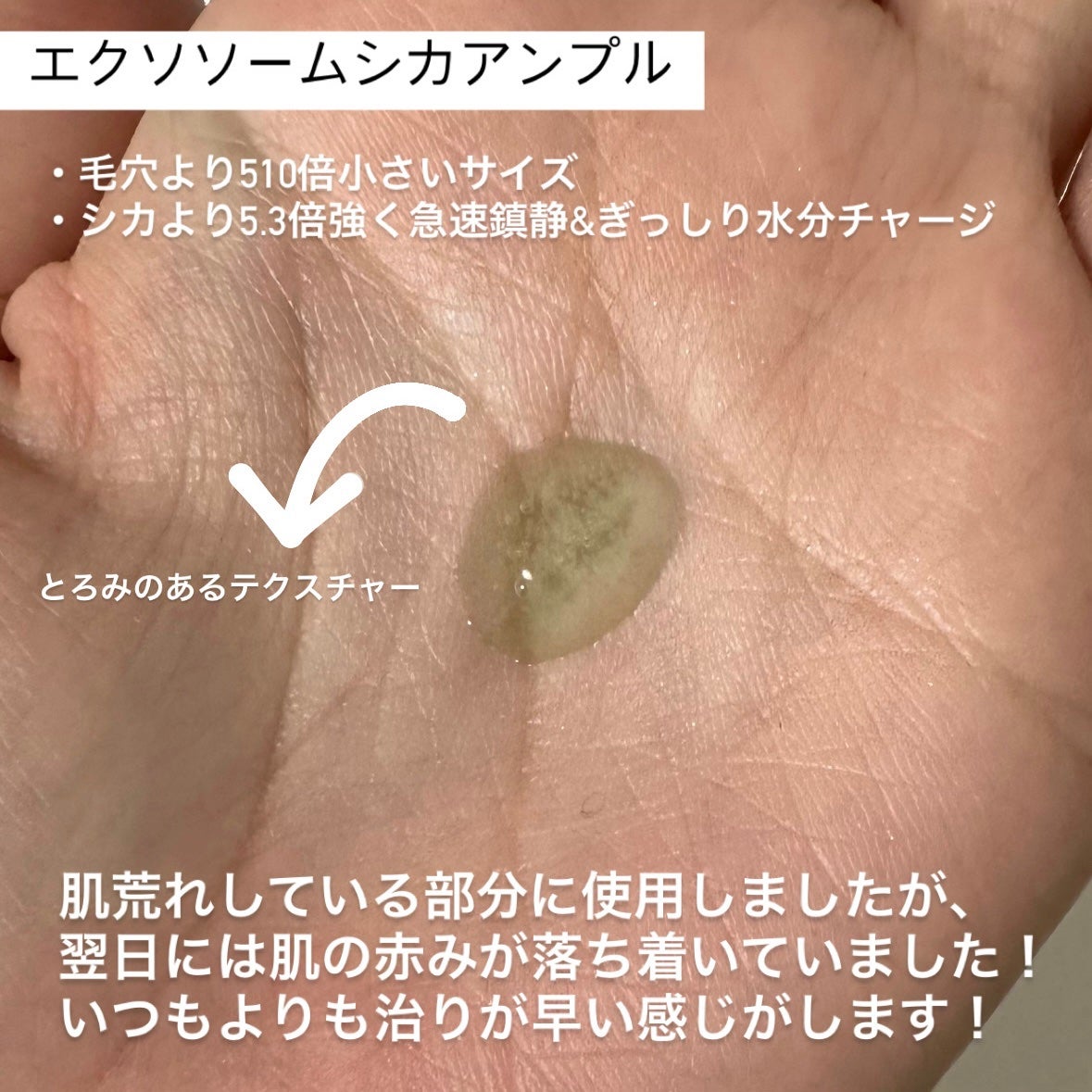 エクソソームシカセラム/MEDICUBE/美容液を使ったクチコミ(2枚目)