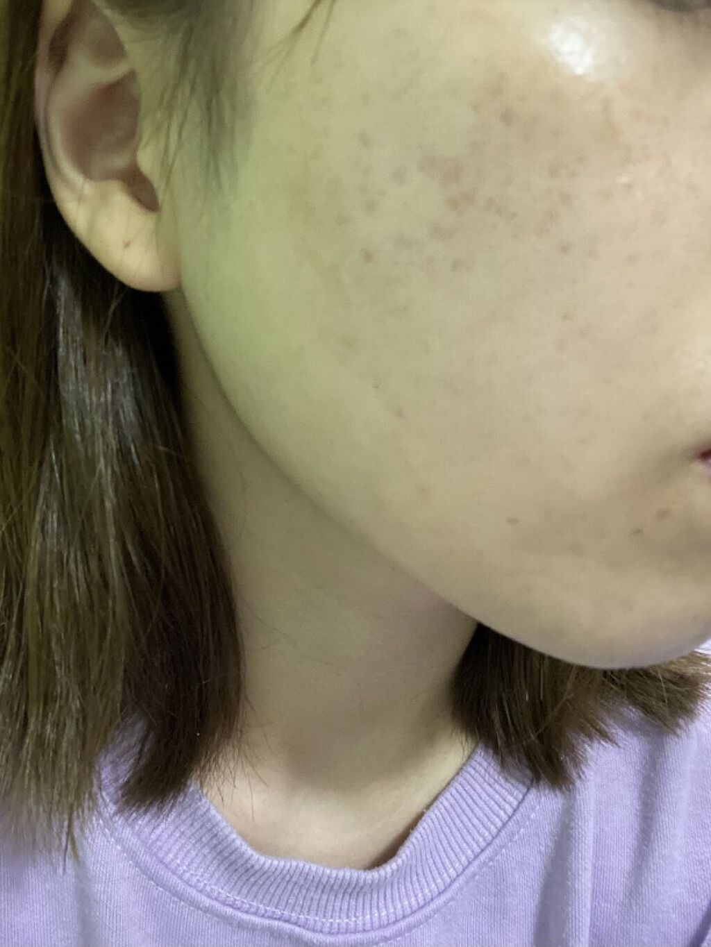 モイスチャー リッチローション(とてもしっとり)/アルージェ/化粧水を使ったクチコミ（1枚目）