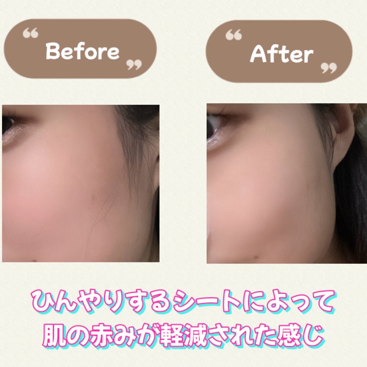 ポストアルファクーリングパッド/Cell Fusion C(セルフュージョンシー)/トナーパッドを使ったクチコミ(3枚目)