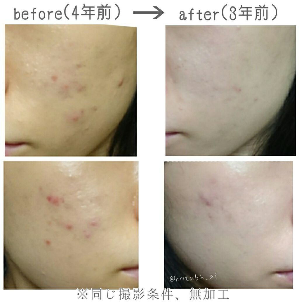 DHC はとむぎエキス/DHC/健康サプリメントを使ったクチコミ（2枚目）