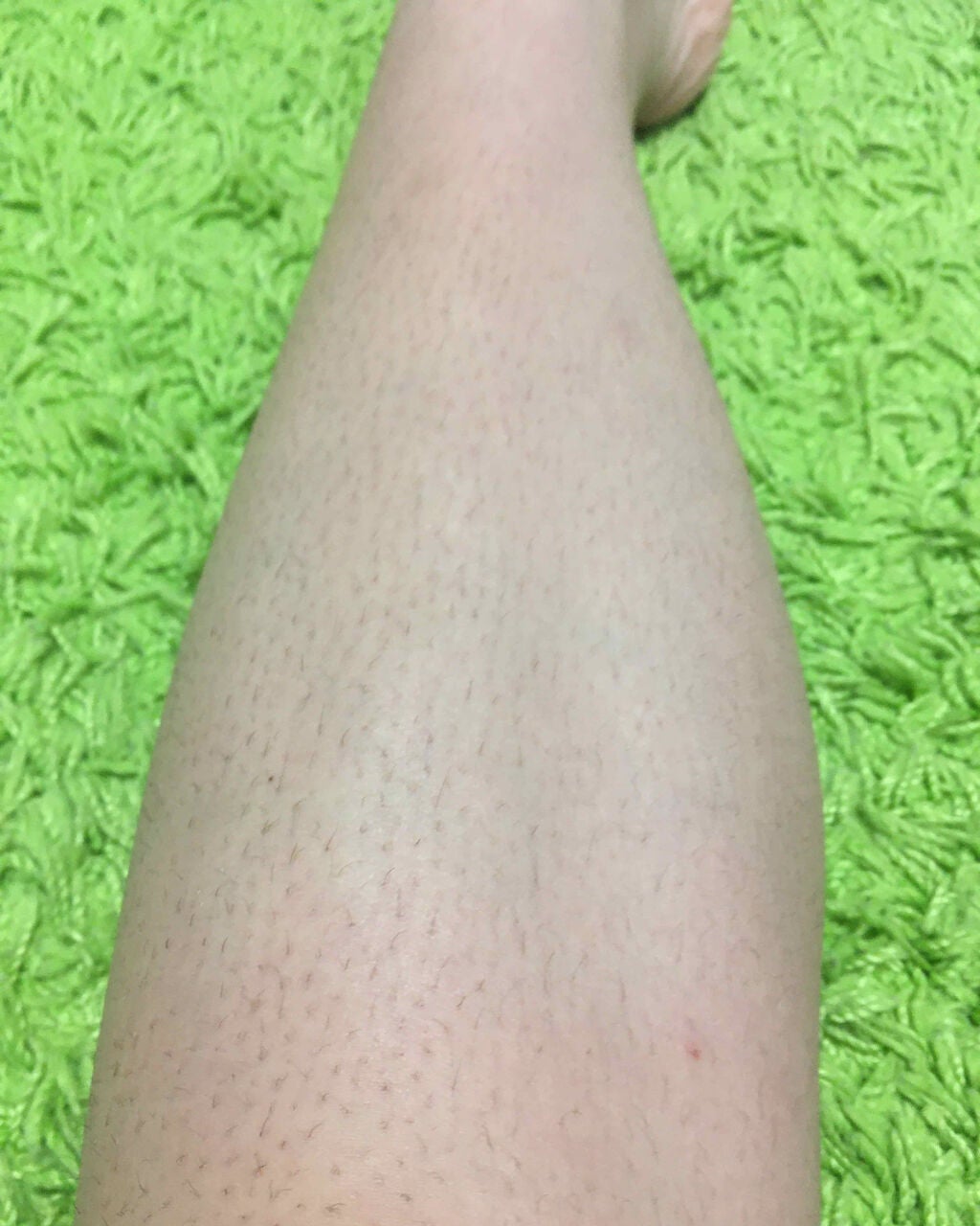 パイナップル豆乳ローション/鈴木ハーブ研究所/除毛クリームを使ったクチコミ(2枚目)