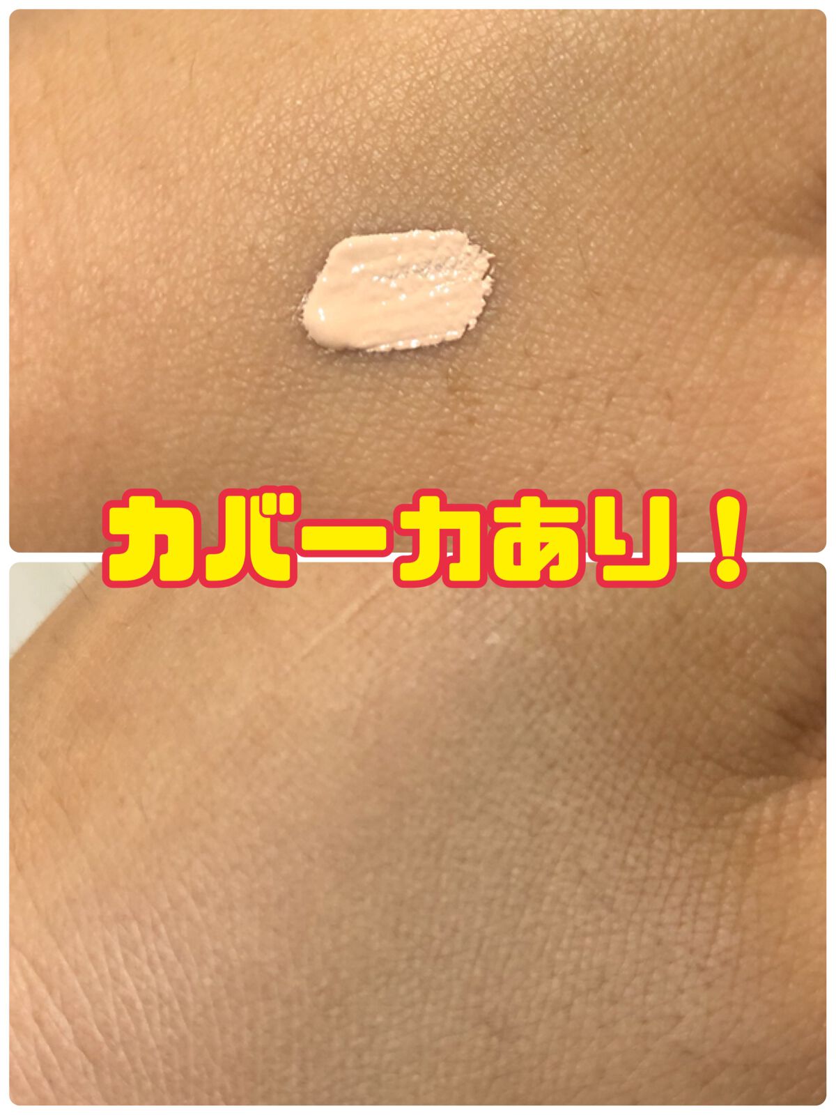 タトゥーウォータープルーフスカーコンシーラー/フォレンコス/リキッドコンシーラーを使ったクチコミ（2枚目）