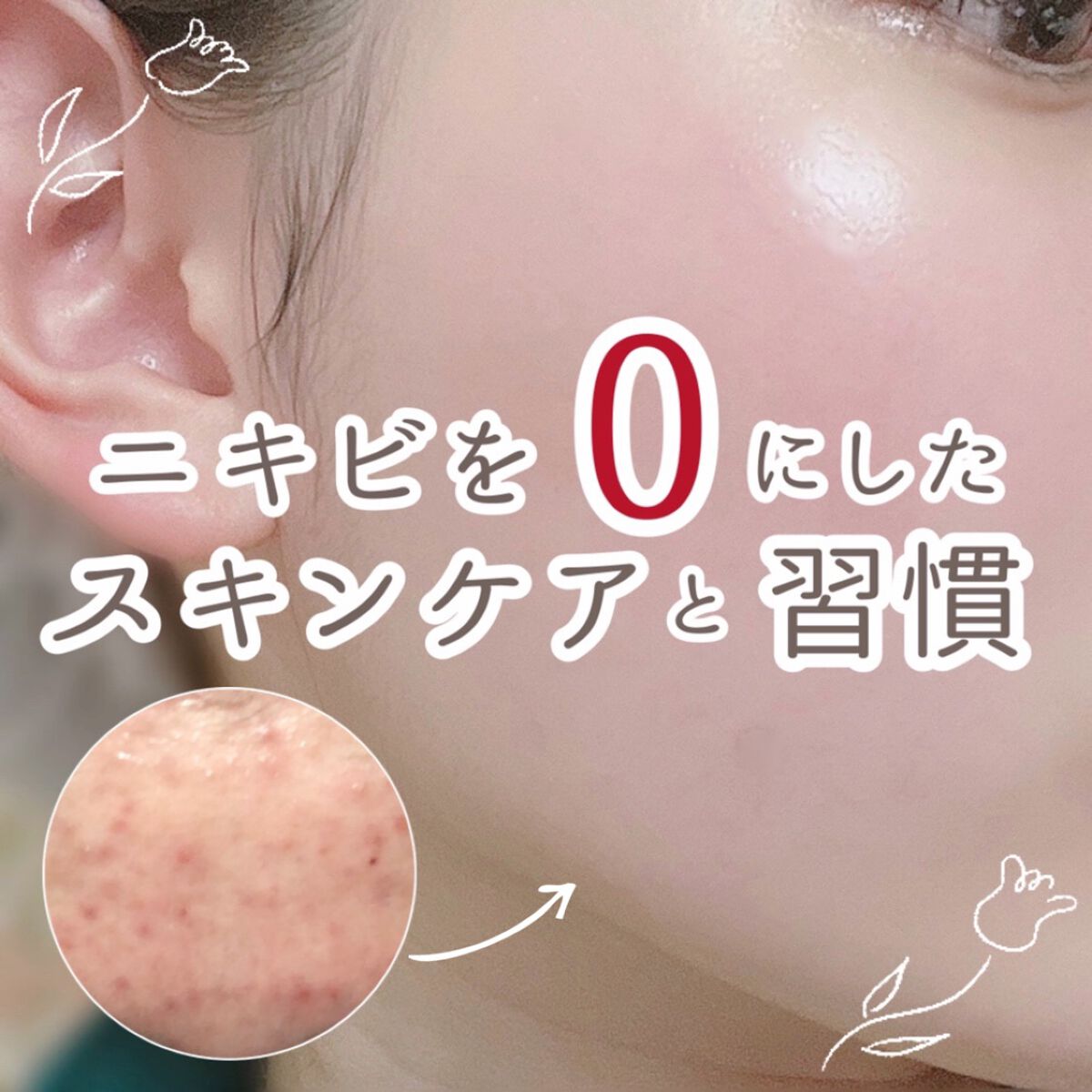 皮脂トラブルケア 化粧水/キュレル/化粧水を使ったクチコミ（1枚目）