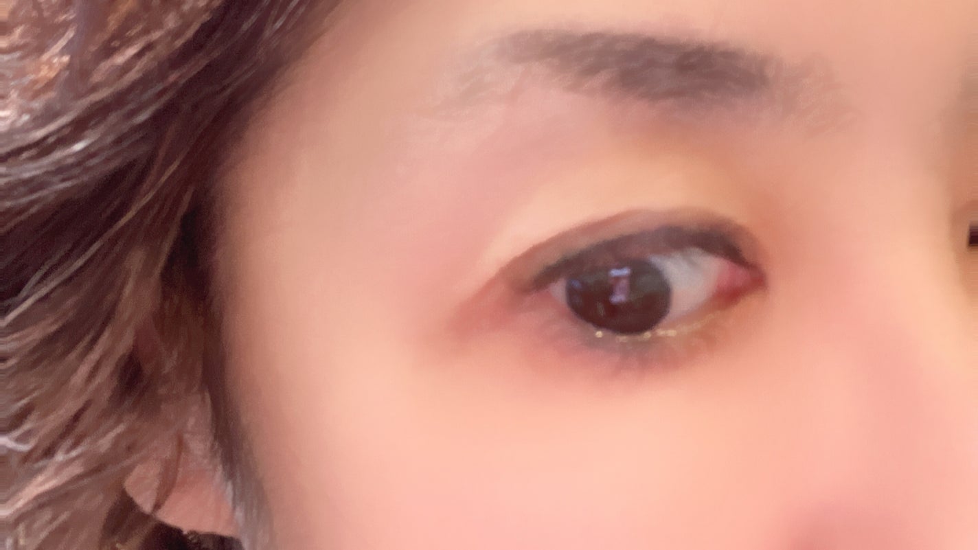 オタネ on LIPS 「一応ふたえではありますけど年と共に3重4重になりどんよりとした..」(4枚目)