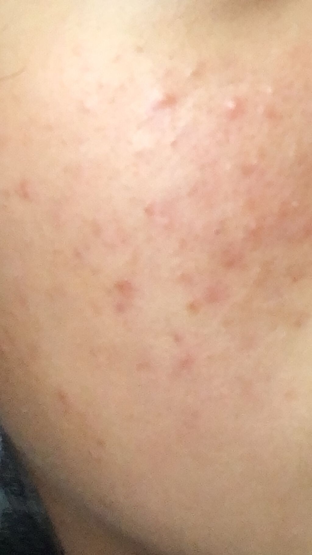 薬用しみ対策 美白化粧水 しっとりタイプ/メラノCC/化粧水を使ったクチコミ（1枚目）