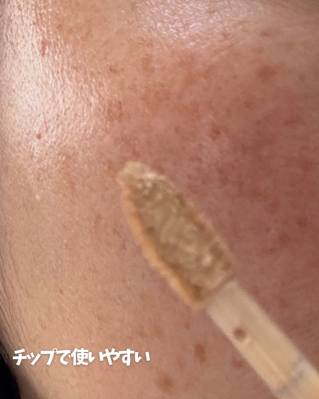 ダーマシンコンシーラー/23years old/リキッドコンシーラーを使ったクチコミ(4枚目)