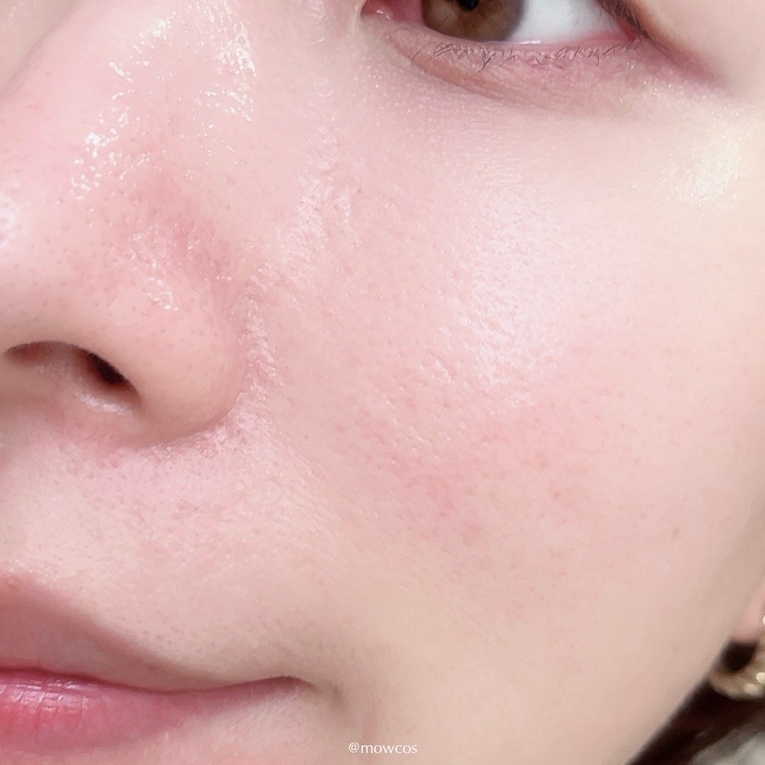 VC100エッセンスローション EX/ドクターシーラボⓇ/化粧水を使ったクチコミ(4枚目)