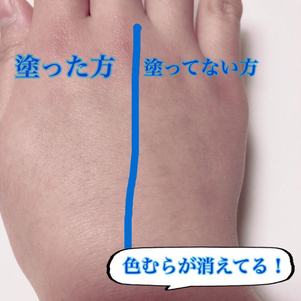 ニキビ治療薬クリーム (医薬品)/クレアラシル/その他を使ったクチコミ(4枚目)