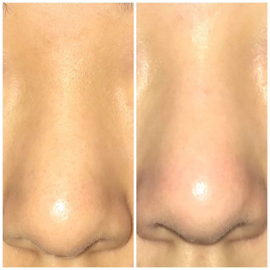 シラクル ビューティシート/Ciracle/トナーパッドを使ったクチコミ(2枚目)