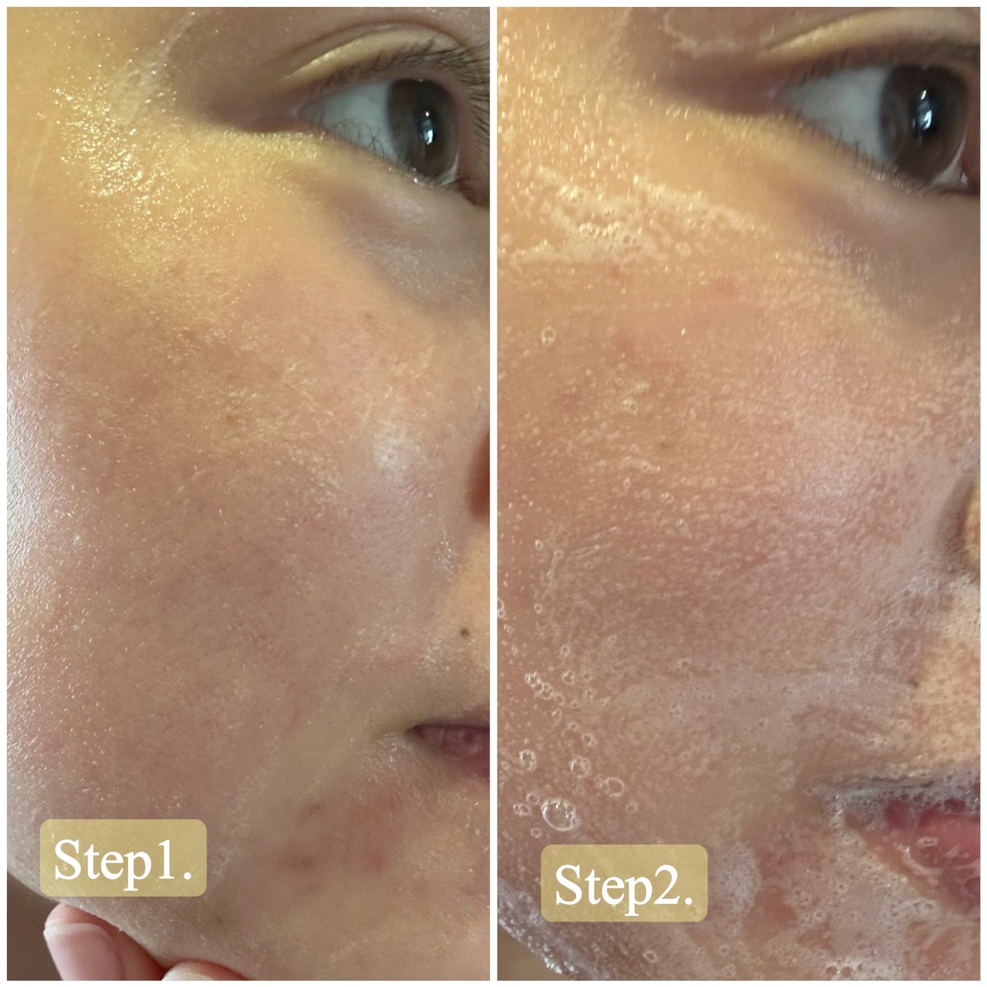 TX-アンプルクレンザー/Dr.Melaxin/美容液を使ったクチコミ(2枚目)