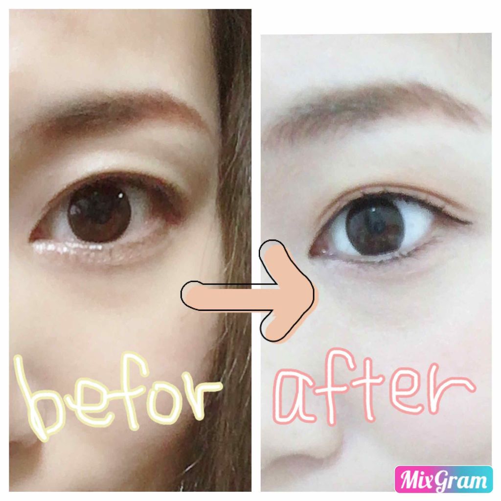 【旧品】オリシキ アイリッドスキンフィルム/D-UP/二重まぶた用アイテムを使ったクチコミ(2枚目)