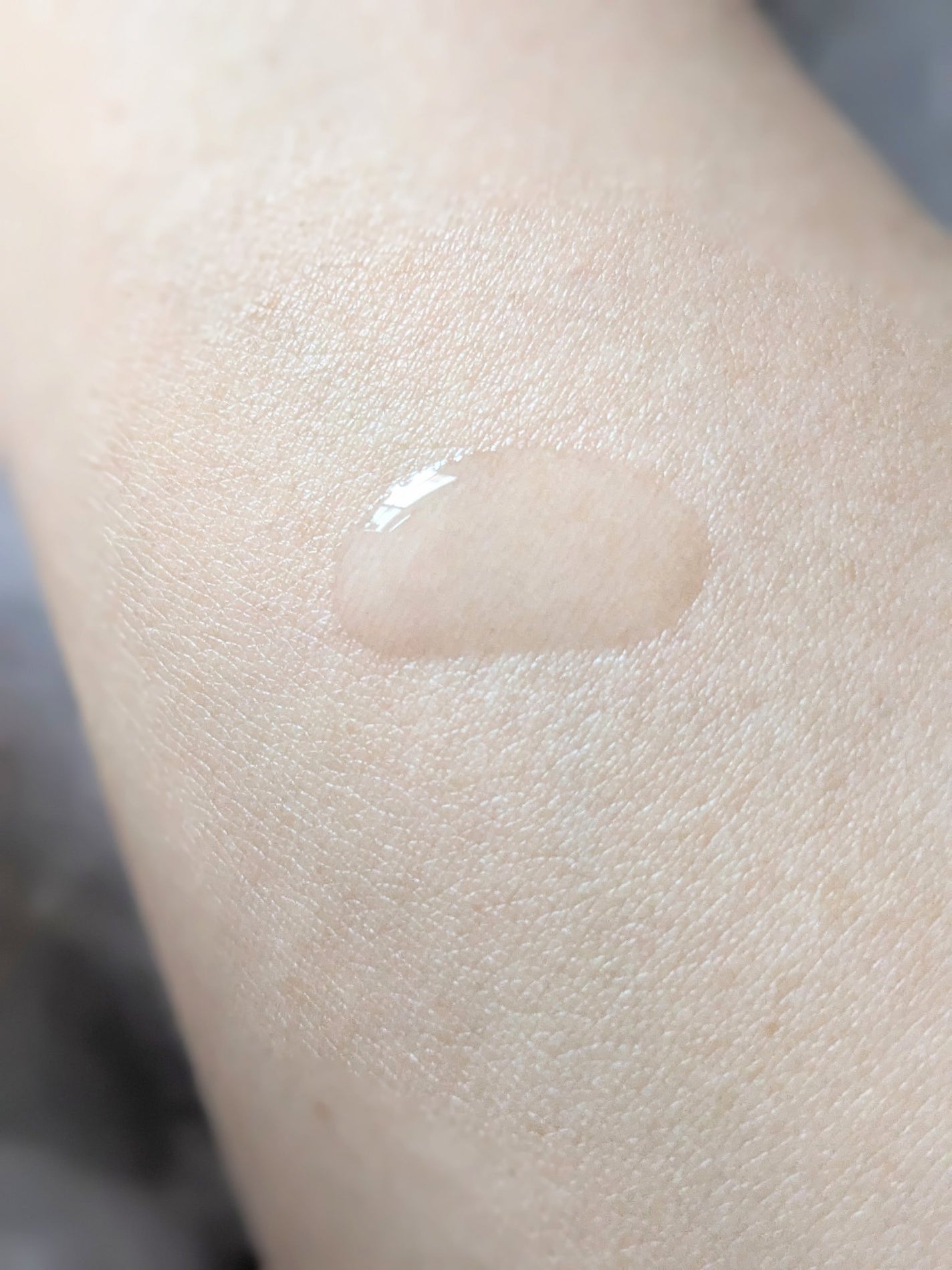 薬用u ローション/AK usual/化粧水を使ったクチコミ(5枚目)