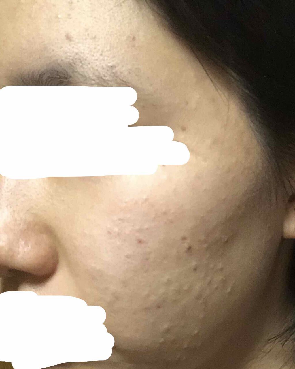 ハトムギ化粧水(ナチュリエ スキンコンディショナー R )/ナチュリエ/化粧水を使ったクチコミ（2枚目）