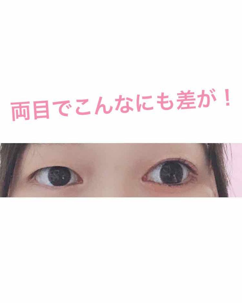 リアルダブルアイリッド/K-パレット/二重まぶた用アイテムを使ったクチコミ(2枚目)