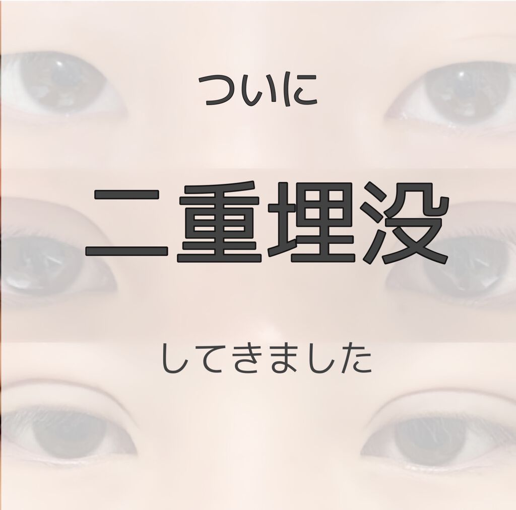 Mol on LIPS 「【念願の二重に】 ずっと悩んでいた埋没手術を受けて来ました。プ..」(1枚目)