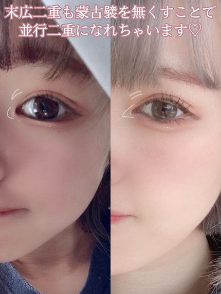 ハトムギ化粧水(ナチュリエ スキンコンディショナー R )/ナチュリエ/化粧水を使ったクチコミ(3枚目)