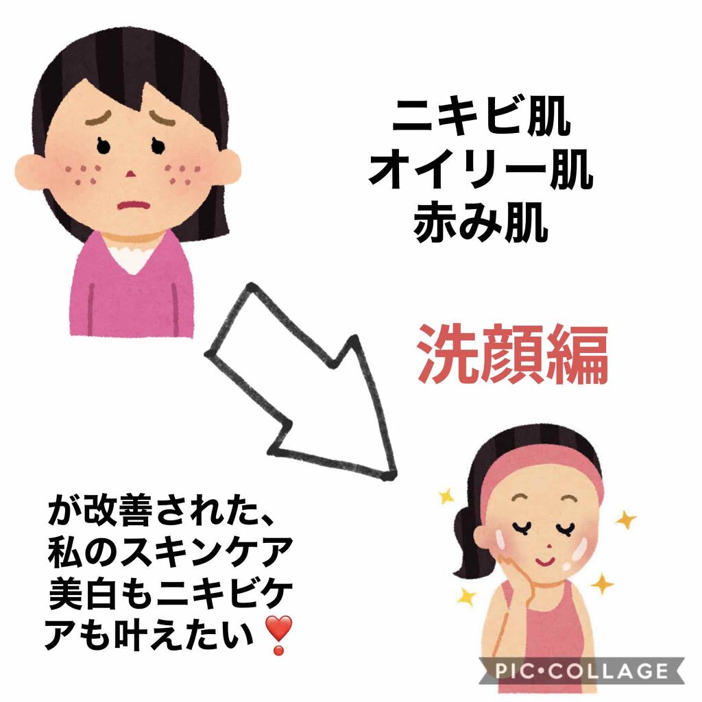 薬用洗顔フォーム/スキンライフ/洗顔フォームを使ったクチコミ（1枚目）