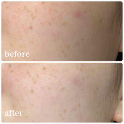 WHITE WHIPPING CREAM(ãŠãŠã¯ãªãŒã )/G9SKIN/åç²§äžå°ã䜿ã£ãã¯ãã³ãïŒ4æç®ïŒ