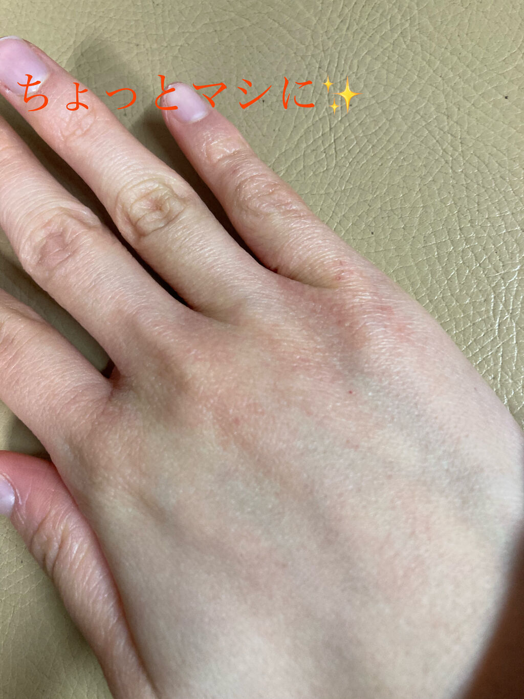 ハンドミルク 本体 200ml/アトリックス/ハンドクリームを使ったクチコミ（3枚目）