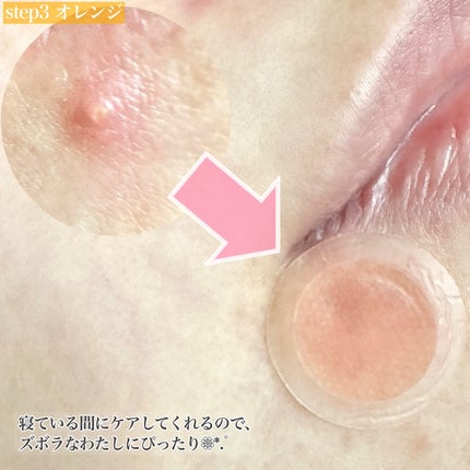 スポットイレイザー/NOLAHOUR/その他スキンケアを使ったクチコミ(7枚目)