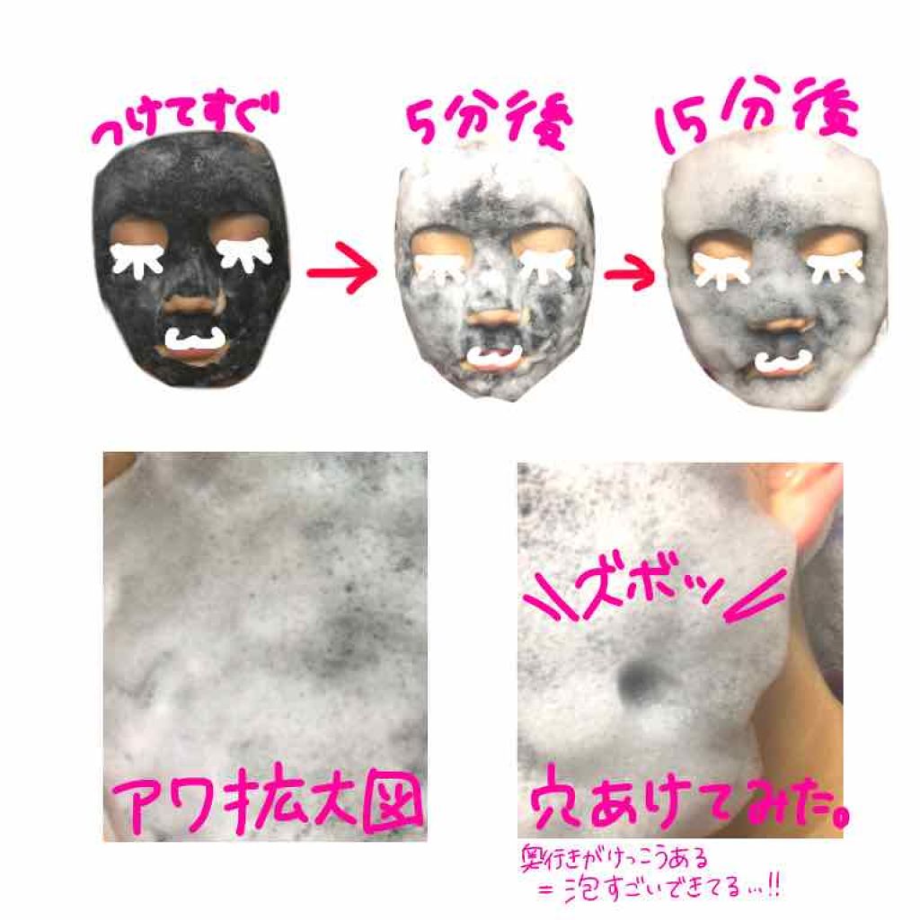 BLACK O2 泡パック charcoal /PUREDERM/シートマスク・パックを使ったクチコミ(2枚目)