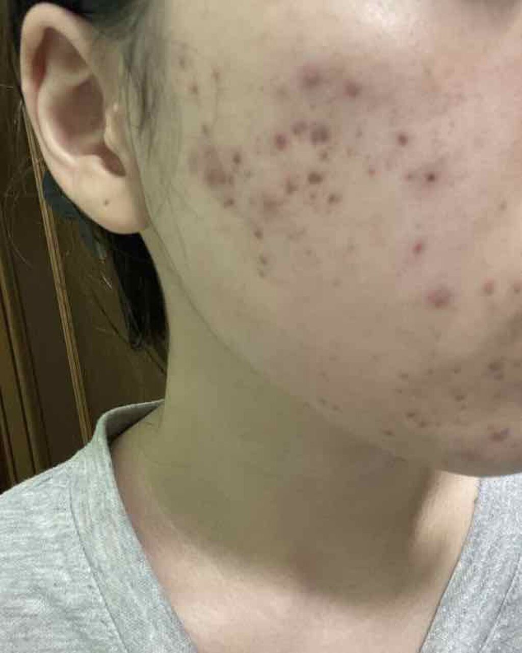 ルルルンプレシャス GREEN(バランス)【旧】/ルルルン/シートマスク・パックを使ったクチコミ(1枚目)