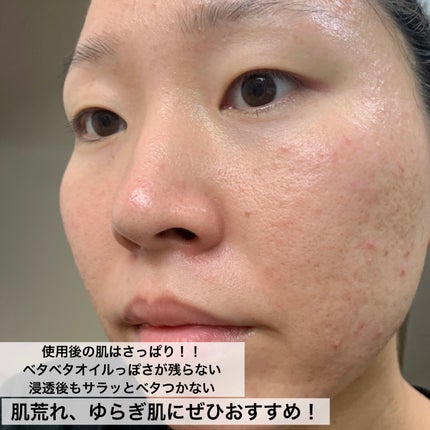 CHOIè¬çšãã¹ã¯ ãããã±ã¢ å»è¬éšå€å/èçŸç²Ÿ/ã·ãŒããã¹ã¯ã»ããã¯ã䜿ã£ãã¯ãã³ãïŒ5æç®ïŒ