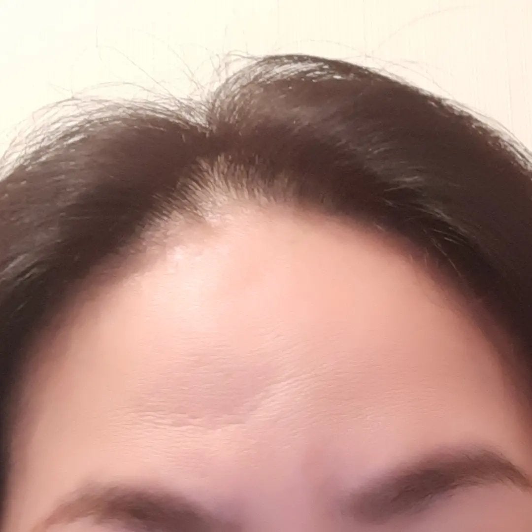 SonoRepro/アンファー(スカルプD)/ヘアケアグッズを使ったクチコミ(3枚目)