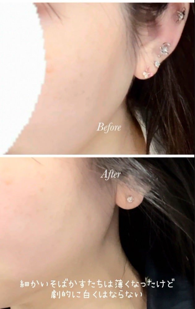 クリスタルトマト美白サプリメント/Crystal tomato/美容サプリメントを使ったクチコミ(7枚目)