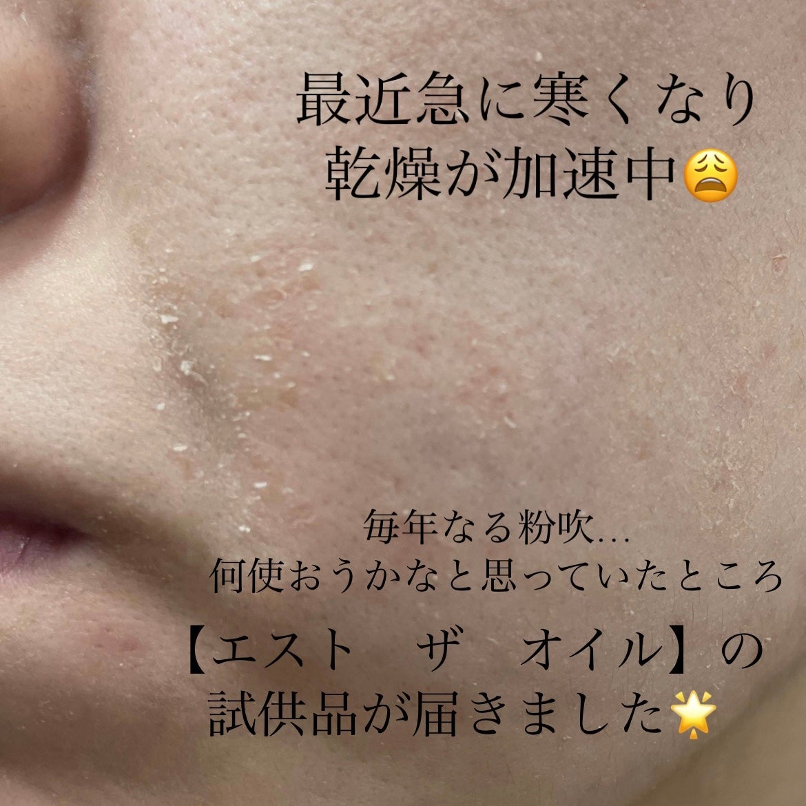 ザ オイル/est/フェイスオイルを使ったクチコミ(3枚目)