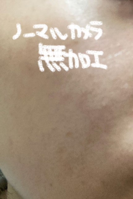 Buffet/The Ordinary/美容液を使ったクチコミ(2枚目)