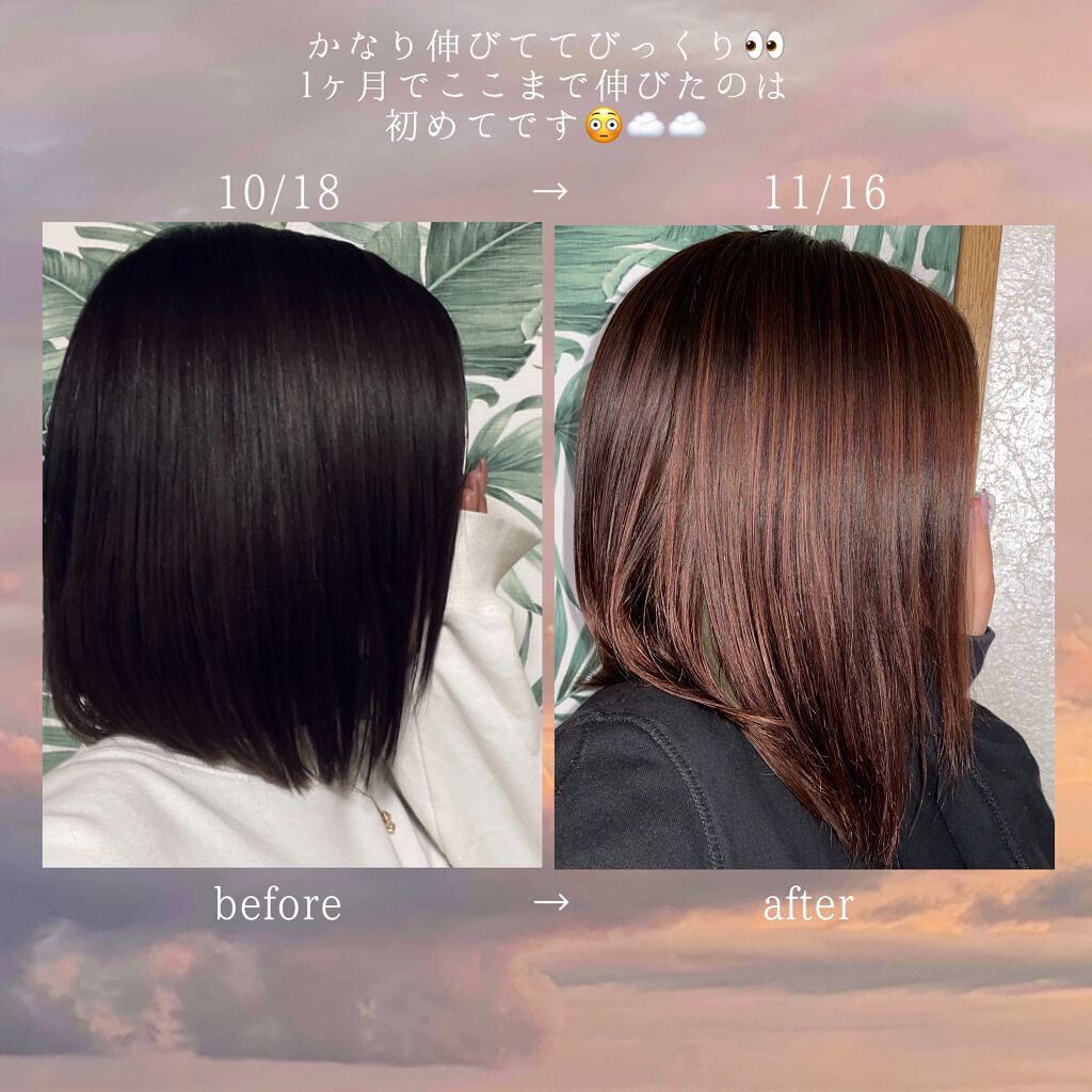 ヘアアクセルレーター レモンライムの香り/加美乃素本舗/頭皮ローションを使ったクチコミ(2枚目)