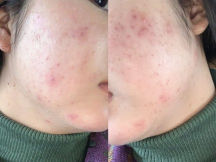 カプチュール トータル ドリームスキン ケア&パーフェクト/Dior/乳液を使ったクチコミ(1枚目)